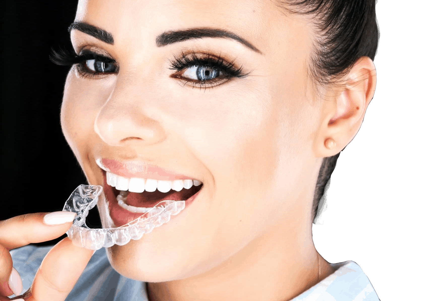 NewSmile®: Night Aligners For Teeth Straightening In Evenings - NewSmile  Canada